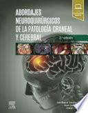 Abordajes Neuroquirúrgicos de la Patología Craneal Y Cerebral
