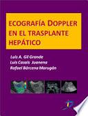 Libro Ecografía Dopple en el trasplante hepático