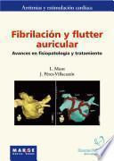 Fibrilación y flutter auricular