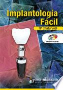Libro Implantología Fácil