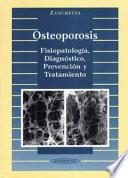 Osteoporosis. Fisiopatología, diagnóstico, prevención y tratamiento